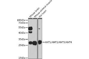 Western blot analysis of extracts of various cell lines, using /// antibody (ABIN7265627) at 1:1000 dilution. (ANT1+ANT2+ANT3+ANT4 (C-Term) anticorps)
