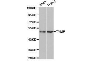 Western Blotting (WB) image for anti-Thymidine Phosphorylase (TYMP) antibody (ABIN1875239) (Thymidine Phosphorylase anticorps)