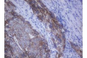 Image no. 4 for anti-Cadherin 1, Type 1, E-Cadherin (Epithelial) (CDH1) antibody (ABIN1497942)