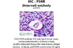 Image no. 1 for anti-Follicle Stimulating Hormone Receptor (FSHR) (Internal Region) antibody (ABIN1734475) (FSHR anticorps  (Internal Region))