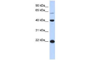 WB Suggested Anti-BLZF1 Antibody Titration: 0. (BLZF1 anticorps  (N-Term))