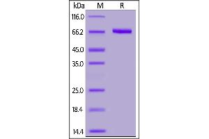 Human Nectin-4, Fc Tag on  under reducing (R) condition. (PVRL4 Protein (AA 32-349) (Fc Tag))