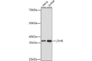 Western blot analysis of extracts of various cell lines, using LDHB Rabbit mAb (ABIN7268170) at 1:1000 dilution. (LDHB anticorps)