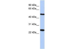 Western Blotting (WB) image for anti-Transmembrane Protein 161B (TMEM161B) antibody (ABIN2459638) (TMEM161B anticorps)