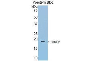 Western Blotting (WB) image for anti-Lecithin-Cholesterol Acyltransferase (LCAT) (AA 290-432) antibody (ABIN1859624) (LCAT anticorps  (AA 290-432))