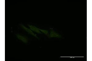 Immunofluorescence of monoclonal antibody to VPS16 on HeLa cell.