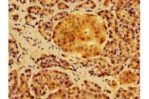 Immunohistochemistry of paraffin-embedded human pancreatic tissue using ABIN7155006 at dilution of 1:100 (HS2ST1 anticorps  (AA 29-229))