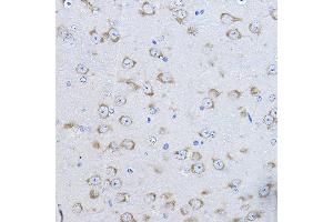 Immunohistochemistry of paraffin-embedded mouse brain using FAK Rabbit pAb (ABIN6131638, ABIN6146424, ABIN6146426 and ABIN6215254) at dilution of 1:100 (40x lens). (FAK anticorps  (AA 425-660))