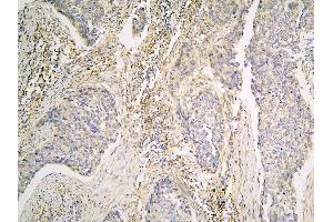 IHC analysis of PPA1 using anti-PPA1 antibody (ABIN6719527). (Pyrophosphatase (Inorganic) 1 (PPA1) (AA 7-236) anticorps)