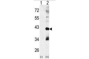 Western blot analysis of CTDSP1 (arrow) using rabbit polyclonal p38 beta Antibody (MAPK11 anticorps  (Middle Region))