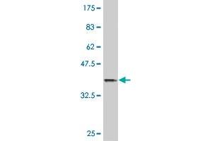 Western Blot detection against Immunogen (36. (HOXB9 anticorps  (AA 65-163))