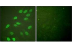 Immunofluorescence (IF) image for anti-Lamin A/C (LMNA) (AA 361-410) antibody (ABIN2888671) (Lamin A/C anticorps  (AA 361-410))