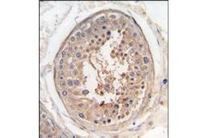 Formalin-fixed and paraffin-embedded human testis tissue reacted with SPAG9 antibody (Center), which was peroxidase-conjugated to the secondary antibody, followed by DAB staining