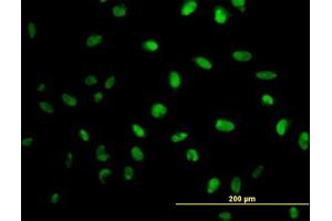 Image no. 3 for anti-N-Methylpurine-DNA Glycosylase (MPG) (AA 1-90) antibody (ABIN598820) (MPG anticorps  (AA 1-90))