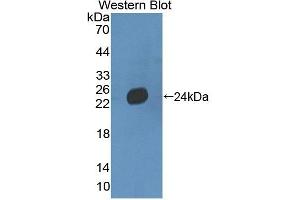 Detection of Recombinant LAMb3, Mouse using Polyclonal Antibody to Laminin Beta 3 (LAMb3) (Laminin beta 3 anticorps  (AA 595-778))
