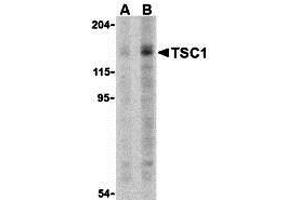 Western Blotting (WB) image for anti-Tuberous Sclerosis 1 (TSC1) (C-Term) antibody (ABIN1030780) (TSC1 anticorps  (C-Term))