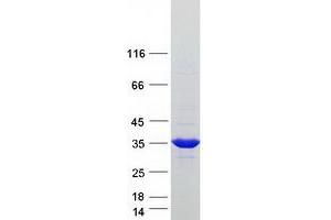 Validation with Western Blot