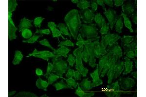 Immunofluorescence of monoclonal antibody to STX4A on HeLa cell. (Syntaxin 4 anticorps  (AA 19-119))