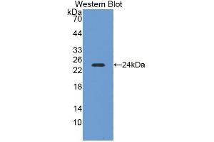 Detection of Recombinant NEIL3, Mouse using Polyclonal Antibody to Nei Endonuclease VIII Like Protein 3 (NEIL3) (NEIL3 anticorps  (AA 2-187))