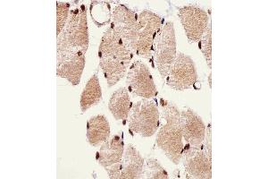anti-Sjogren Syndrome Nuclear Autoantigen 1 (SSNA1) (AA 25-53), (N-Term) antibody