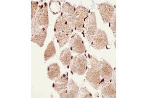 Immunohistochemical analysis of paraffin-embedded H. (SSNA1 anticorps  (N-Term))
