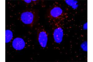 Proximity Ligation Analysis of protein-protein interactions between AKT1 and SMAD4.