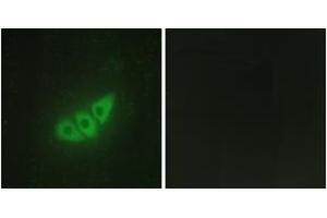 Immunofluorescence analysis of HepG2 cells, using E2AK3 Antibody.