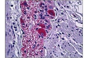 Human Colon, Peripheral Nerve: Formalin-Fixed, Paraffin-Embedded (FFPE)