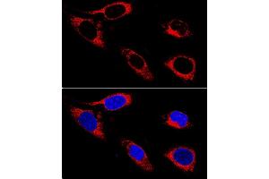 anti-Prolyl 4-Hydroxylase, beta Polypeptide (P4HB) (AA 329-508) antibody