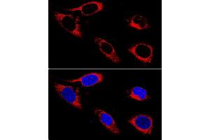 Confocal immunofluorescence analysis of U-2OS cells using P4HB antibody (ABIN3021093, ABIN3021094, ABIN3021095 and ABIN1513299) at dilution of 1:400. (P4HB anticorps  (AA 329-508))