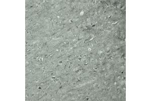 IHC on mouse brain (cryo section) using Rabbit antibody to Synaptotagmin 17  at a concentration of 50 µg/ml incubated overnight at 4C. (SYT17 anticorps  (Internal Region))