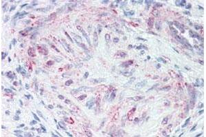 Immunohistochemical (Formalin/PFA-fixed paraffin-embedded sections) staining in human uterus, vessel with MLNR polyclonal antibody . (Motilin Receptor anticorps  (Cytoplasmic Domain))