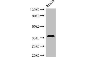 Western Blot Positive WB detected in: Mouse brain tissue All lanes: RNF126 antibody at 2. (RNF126 anticorps  (AA 39-225))