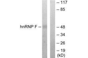 Western blot analysis of extracts from HepG2 cells, using hnRNP F antibody. (HNRNPF anticorps  (N-Term))