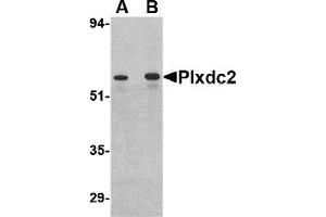 Western Blotting (WB) image for anti-Plexin Domain Containing 2 (PLXDC2) (C-Term) antibody (ABIN1030593) (PLXDC2 anticorps  (C-Term))