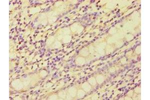 Immunohistochemistry of paraffin-embedded human colon tissue using ABIN7149359 at dilution of 1:100