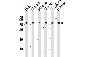 Western blot analysis of lysates from Hela cell line, mouse brain, mouse testis, mouse lung, mouse spleen, rat brain tissue (from left to right), using Mouse Cbx7 Antibody (C-term) (ABIN6243434 and ABIN6577610). (CBX7 anticorps  (C-Term))