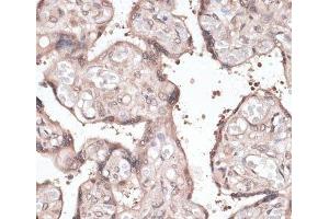 Immunohistochemistry of paraffin-embedded Human placenta using CCNE2 Polyclonal Antibody at dilution of 1:100 (40x lens).
