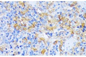 Immunohistochemistry of paraffin-embedded Rat spleen using AARS Polyclonal Antibody at dilution of 1:100 (40x lens).