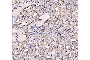 IHC analysis of HECTD1 using anti-HECTD1 antibody (ABIN7601584). (HECTD1 anticorps  (AA 39-566))