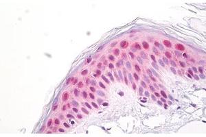 Anti-MP-44 / NUP53 antibody IHC staining of human skin, epidermis. (NUP35 anticorps  (AA 50-100))