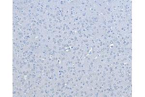 IHC analysis of B Raf/BRAF using anti-B Raf/BRAF antibody (ABIN3043761). (BRAF anticorps  (AA 38-230))