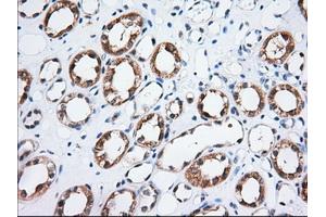 Immunohistochemical staining of paraffin-embedded Human Kidney tissue using anti-TTC32 mouse monoclonal antibody. (TTC32 anticorps)