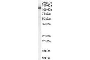 Western Blotting (WB) image for anti-USO1 Homolog, Vesicle Docking Protein (USO1) (AA 961-972) antibody (ABIN297849) (USO1 anticorps  (AA 961-972))