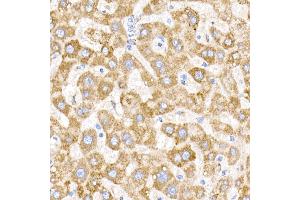 Immunohistochemistry of paraffin-embedded human liver using NDUFB9 Rabbit mAb (ABIN7268815) at dilution of 1:200 (40x lens). (NDUFB9 anticorps)