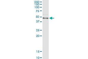 FASN (Human) IP-WB Antibody Pair
