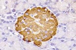 Immunohistochemistry analysis of paraffin-embedded mouse white fat using,GPR120 (ABIN7074942) at dilution of 1: 2000