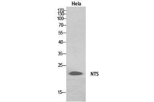 Western Blot (WB) analysis of HeLa, HepG2 cells using Neurotensin Polyclonal Antibody.
