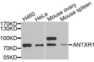 Western blot analysis of extracts of various cells, using ANTXR1 antibody. (ANTXR1 anticorps)