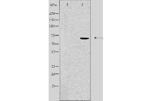 Western blot analysis of extracts from 293 cells, using KCNA5 antibody. (KCNA5 anticorps  (Internal Region))